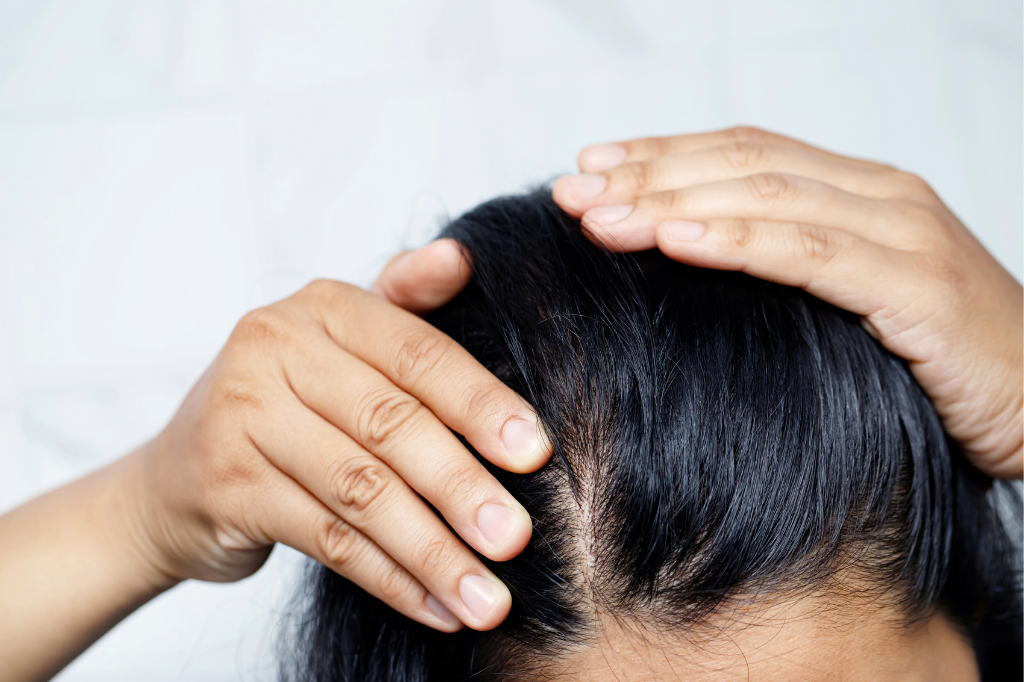 FK - Como cuidar do cabelo oleoso: passo a passo