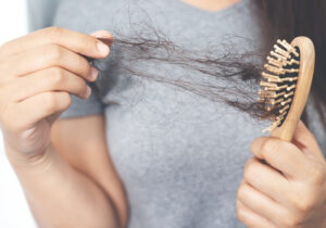 FK - Queda de cabelo