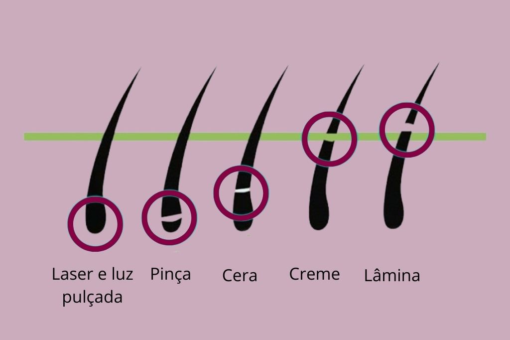 FK - Tipos de depilação corpo1
